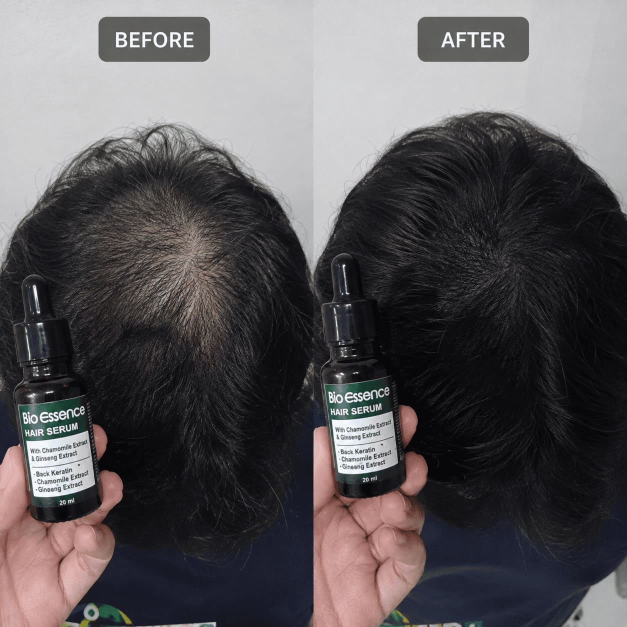 Before After Crown