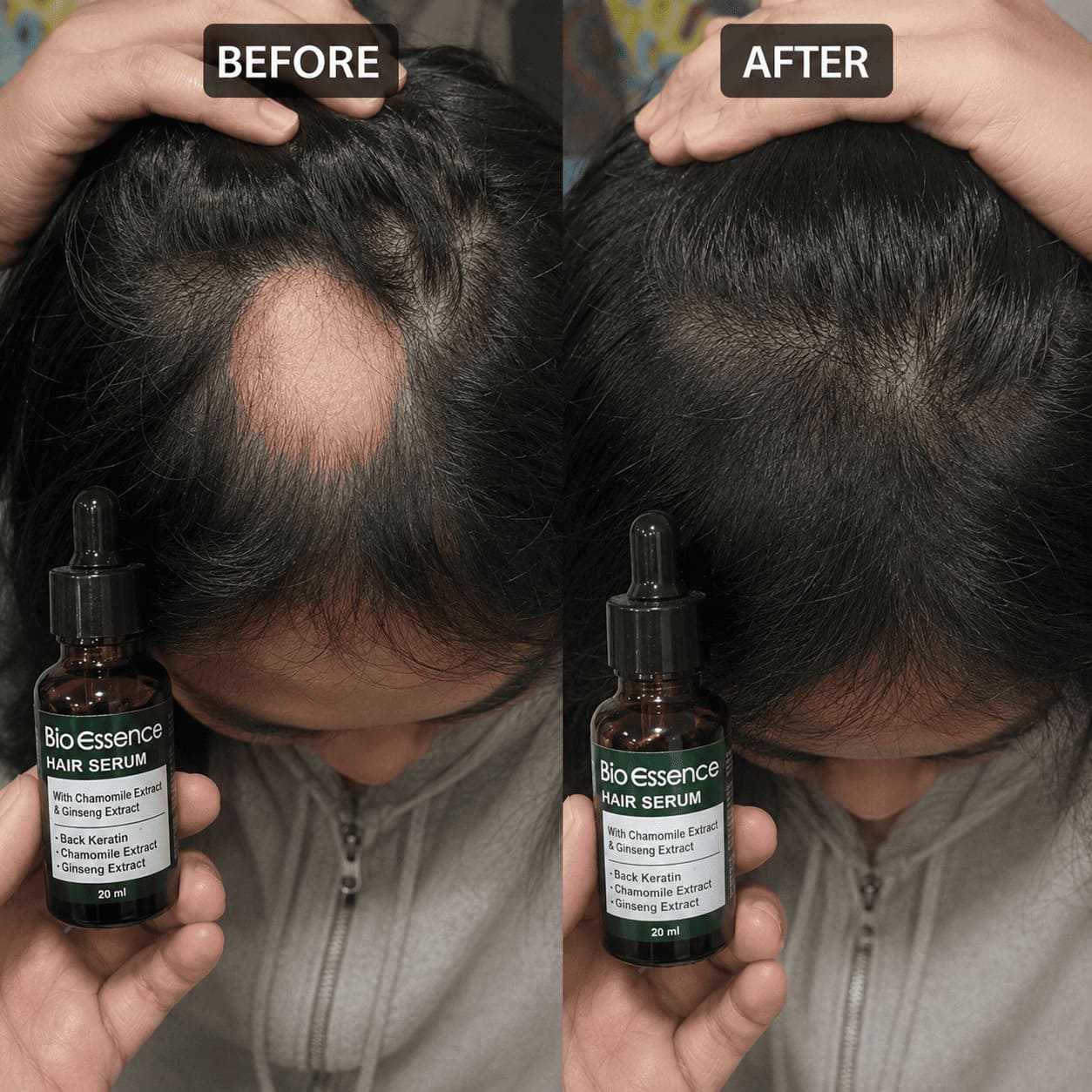 Before After Pitak Koin