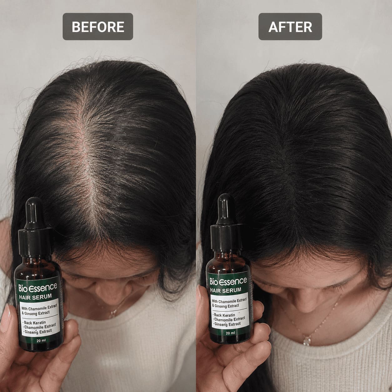 Before After Rambut Tipis